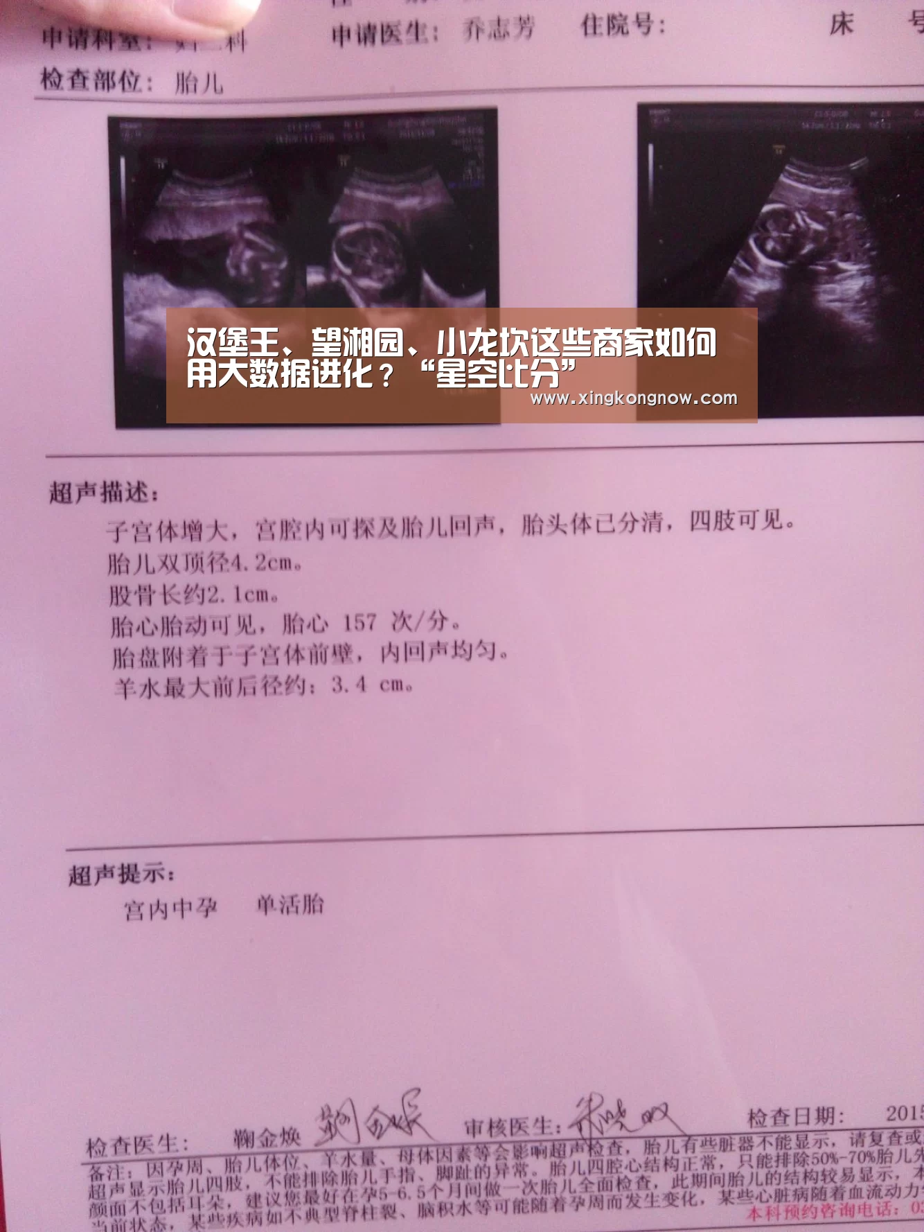 汉堡王、望湘园、小龙坎这些商家如何用大数据进化?“星空比分”(图2) 星空聚合